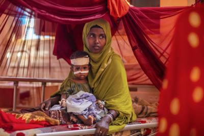 Ayan Muhammed, sostiene a su hijo Fahir, quien sufre desnutrición severa, mientras recibe tratamiento, en un centro de estabilización respaldado por UNICEF en el hospital Gode, en la zona de Shabelle de la región de Somali, Etiopía, el 12 de abril de 2022. (Zerihun Sewunet/UNICEF vía AP)