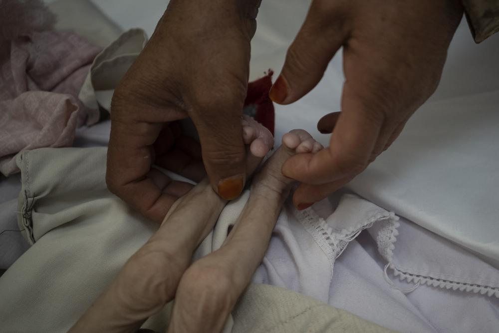 La madrastra de Mohammed, de 4 años, que está desnutrida, se sostiene las piernas en el hospital Indira Gandhi en Kabul, Afganistán, el lunes 8 de noviembre de 2021.El número de personas que viven en Afganistán en condiciones cercanas a la hambruna ha aumentado a 8,7. millones según el Programa Mundial de Alimentos.  (Foto AP / Bram Janssen)