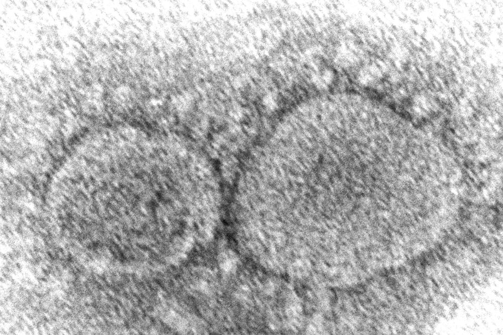 FILE - This 2020 electron microscope image made available by the Centers for Disease Control and Prevention shows SARS-CoV-2 virus particles which cause COVID-19. Nearly two years into the COVID-19 pandemic, the origin of the virus tormenting the world remains shrouded in mystery. (Hannah A. Bullock, Azaibi Tamin/CDC via AP, File)