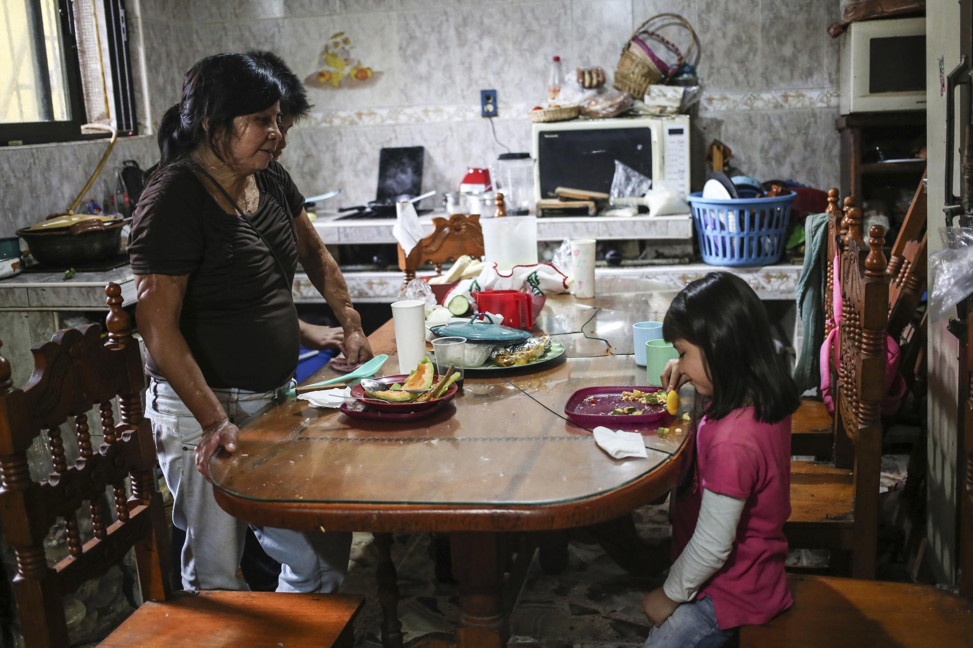 Elisa Xolalpa, who survived an acid attack while tied to a post by her ex-partner 20 years ago when she was 18, waits for her six-year-old daughter Monserrat to finish lunch in the kitchen of Elisa's parents' home in Mexico City, Sunday, July 4, 2021. Xolalpa recognizes that one day she will have to explain to her three daughters, product of another relationship, the attack that changed her life and for a time left her wanting to die. (AP Photo/Ginnette Riquelme)