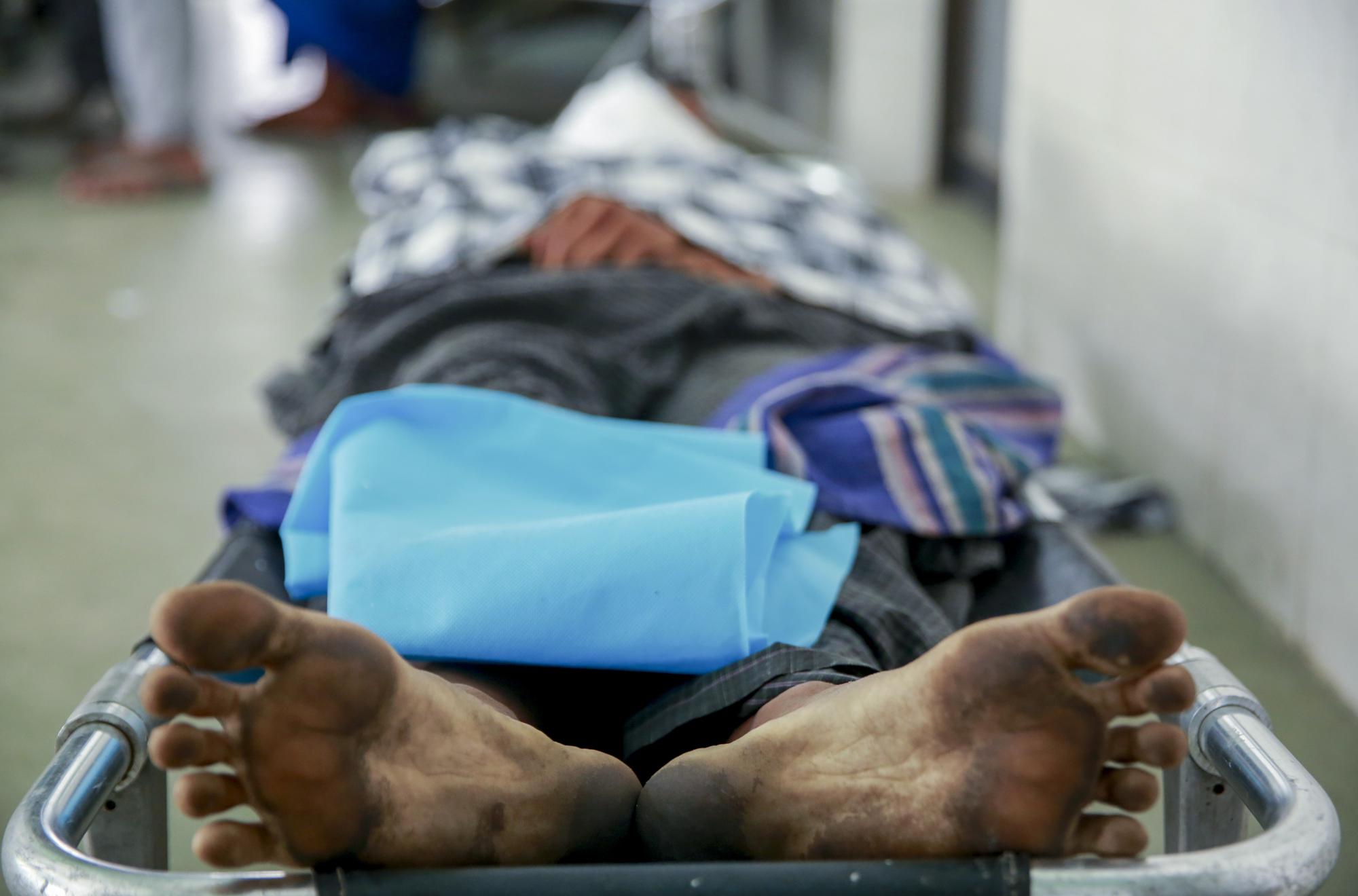 FILE - In this Tuesday, March 23, 2021 file photo, the body of a man who a doctor said was shot and killed by Myanmar security forces during an anti-military takeover protest, lies on a stretcher in Mandalay, Myanmar. Since the military seized control of Myanmar on Feb. 1, more than an estimated 800 people have been killed _ three times the official tally _ according to the Assistance Association for Political Prisoners, as of April 13. (AP Photo)