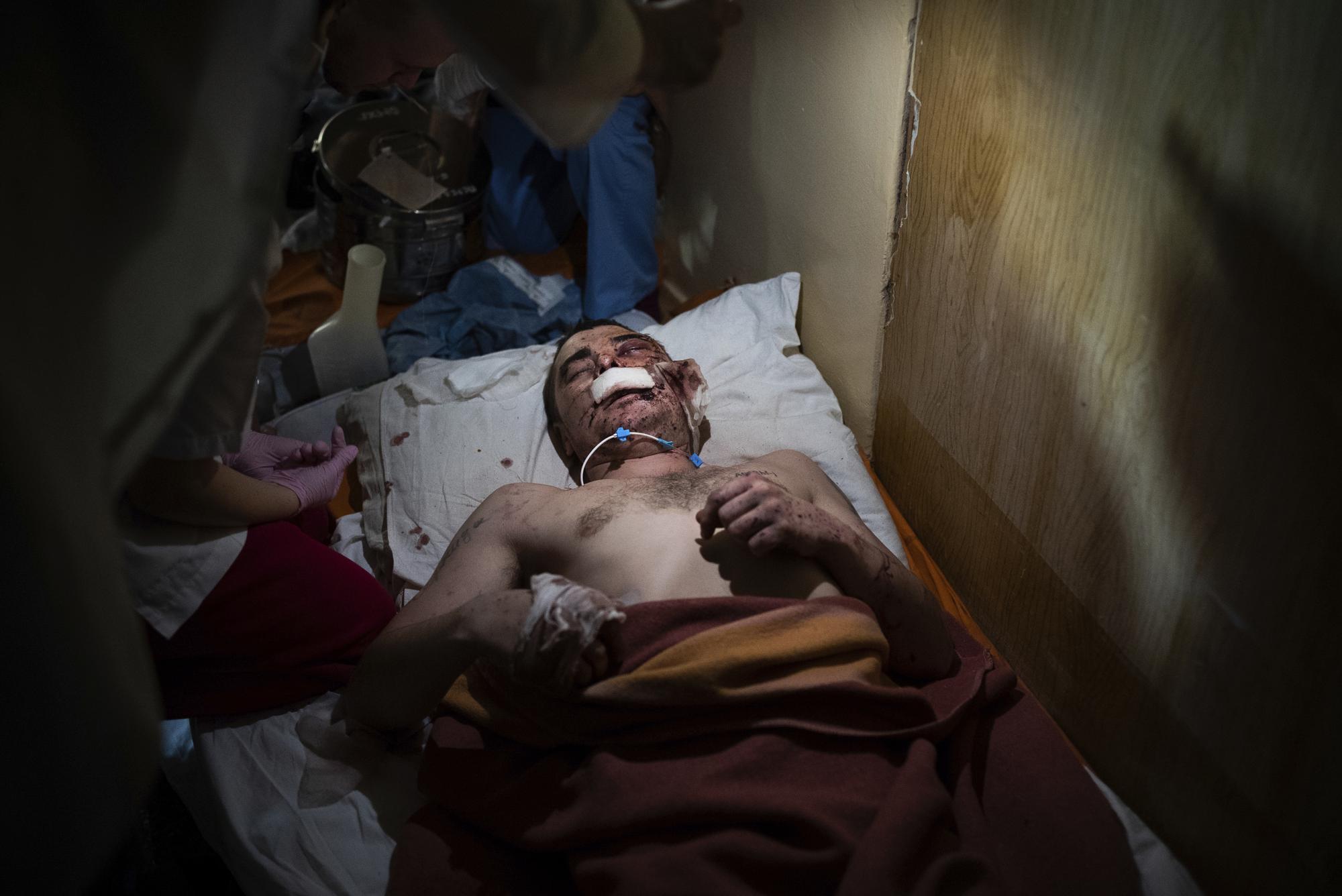 Medical workers treat a man, wounded by shelling, in a hospital in Mariupol, Ukraine, Friday, March 4, 2022. (AP Photo/Mstyslav Chernov)