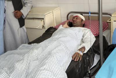 Un afgano en una cama de hospital después de que una bomba caminera estallara al paso de un minibús de estudiantes y profesores universitarios en Kapisa, en la provincia norteña de Kabul, Afganistán. (AP Foto/Farid Tanha)