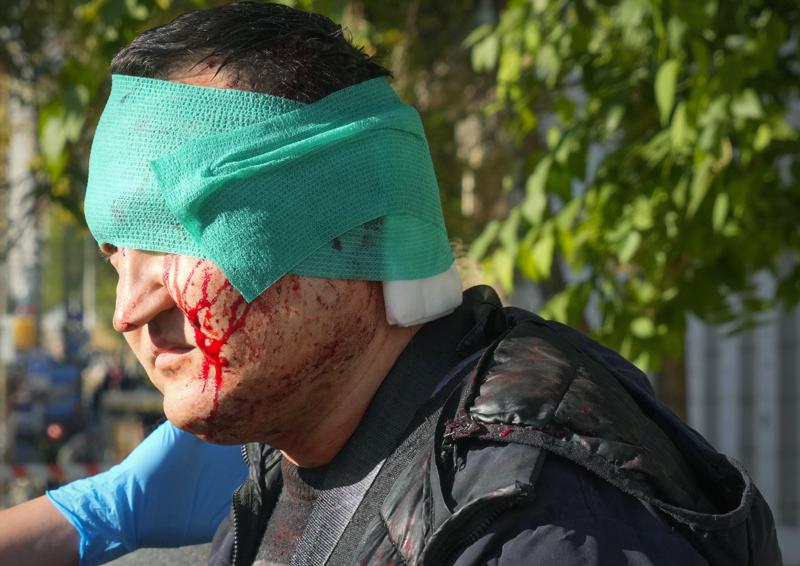 An injured man receives medical treatment at the scene of Russian shelling, in Kyiv, Ukraine, Monday, Oct. 10, 2022. Multiple explosions rocked Kyiv early Monday following months of relative calm in the Ukrainian capital. Kyiv Mayor Vitali Klitschko reported explosions in the city's Shevchenko district, a large area in the center of Kyiv that includes the historic old town as well as several government offices. (AP Photo/Efrem Lukatsky)