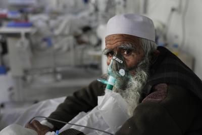 Un paciente con COVID-19 mira a la cámara desde una cama de terapia intensiva, el lunes 7 de febrero de 2022, en Kabul, Afganistán. (AP Foto/Hussein Malla)