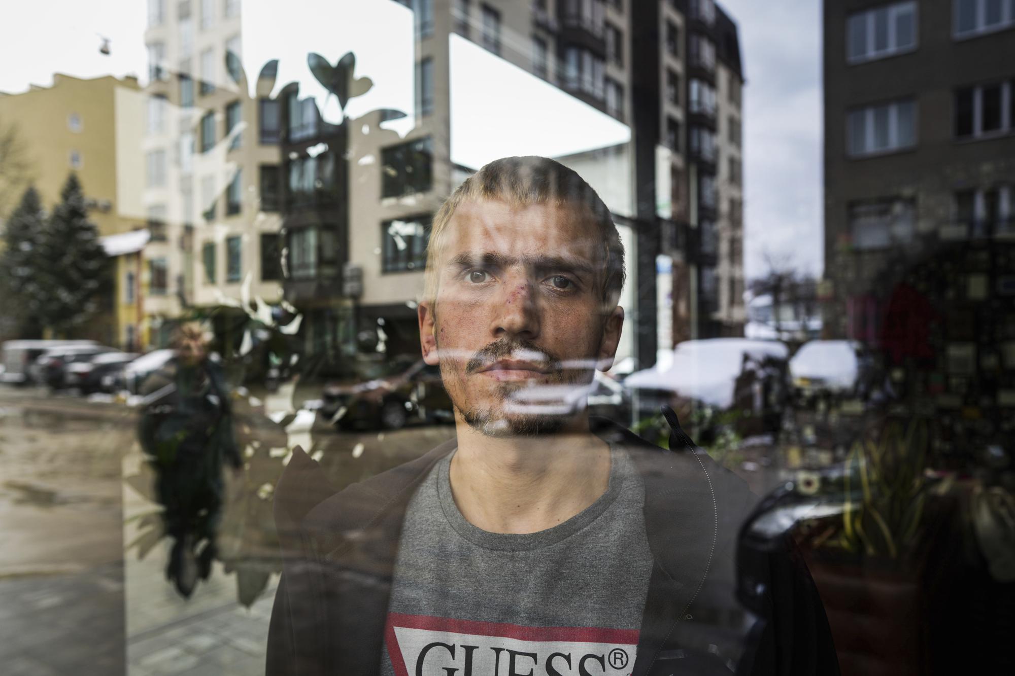 Dmitriy Yurin, who was nearby the bombing at the Donetsk Academic Regional Drama Theatre on March 16, 2022, poses for a photo in Lviv, Ukraine, on Sunday, April 3, 2022. Yurin ran to help, dragging those who were alive but couldn't walk out of the building. (AP Photo/Evgeniy Maloletka)