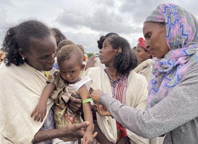 Un niñito es examinado por malnutrición por trabajadores del Programa Mundial de Alimentos en el distrito de Adi Daero en la región de Tigray, en el norte de Etiopía el 21 de agosto del 2021. (Claire Nevill/WFP vía AP)