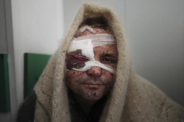 Serhiy Kralya, de 41 años, mira a la cámara después de una cirugía en un hospital en Mariupol, al este de Ucrania, el viernes 11 de marzo de 2022. Kralya resultó herido durante los bombardeos de las fuerzas rusas. (AP Foto/Evgeniy Maloletka)