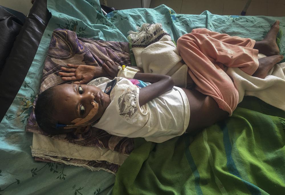 In this photo provided anonymously, Genet Mehari, 5, is treated for malnutrition but with limited medicine, at the Ayder Referral Hospital in Mekele, in the Tigray region of northern Ethiopia, Tuesday, Sept. 28, 2021. In the regional capital Mekele, a year of war and months of government-enforced deprivation have left the city of a half-million people with a rapidly shrinking stock of food, fuel, medicine and cash. (AP Photo)