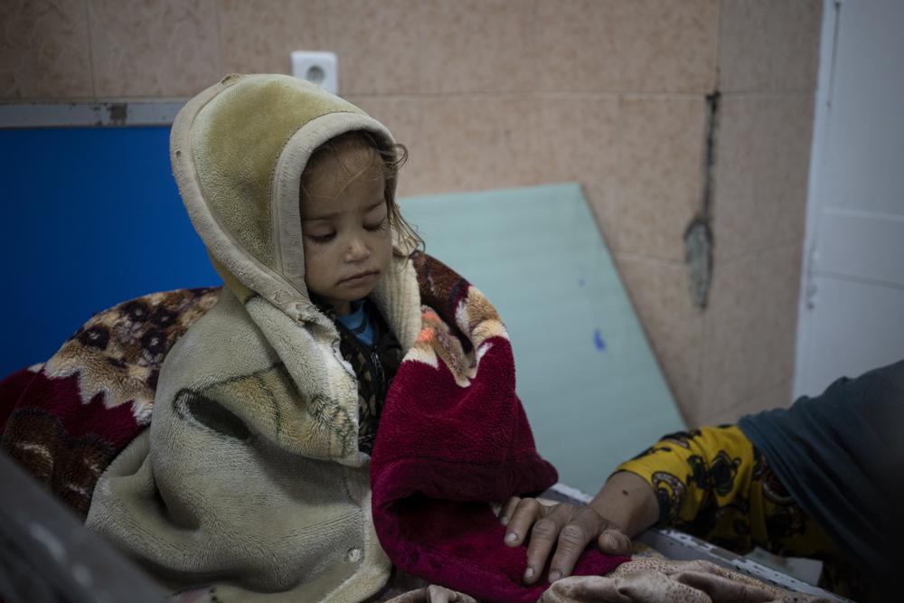 Guldana, de 2 años, que está desnutrido, se sienta en una cama de hospital en el hospital Indira Gandhi en Kabul, Afganistán, el lunes 8 de noviembre de 2021. El número de personas que viven en Afganistán en condiciones cercanas a la hambruna ha aumentado a 8,7 millones. según el Programa Mundial de Alimentos.  (Foto AP / Bram Janssen)
