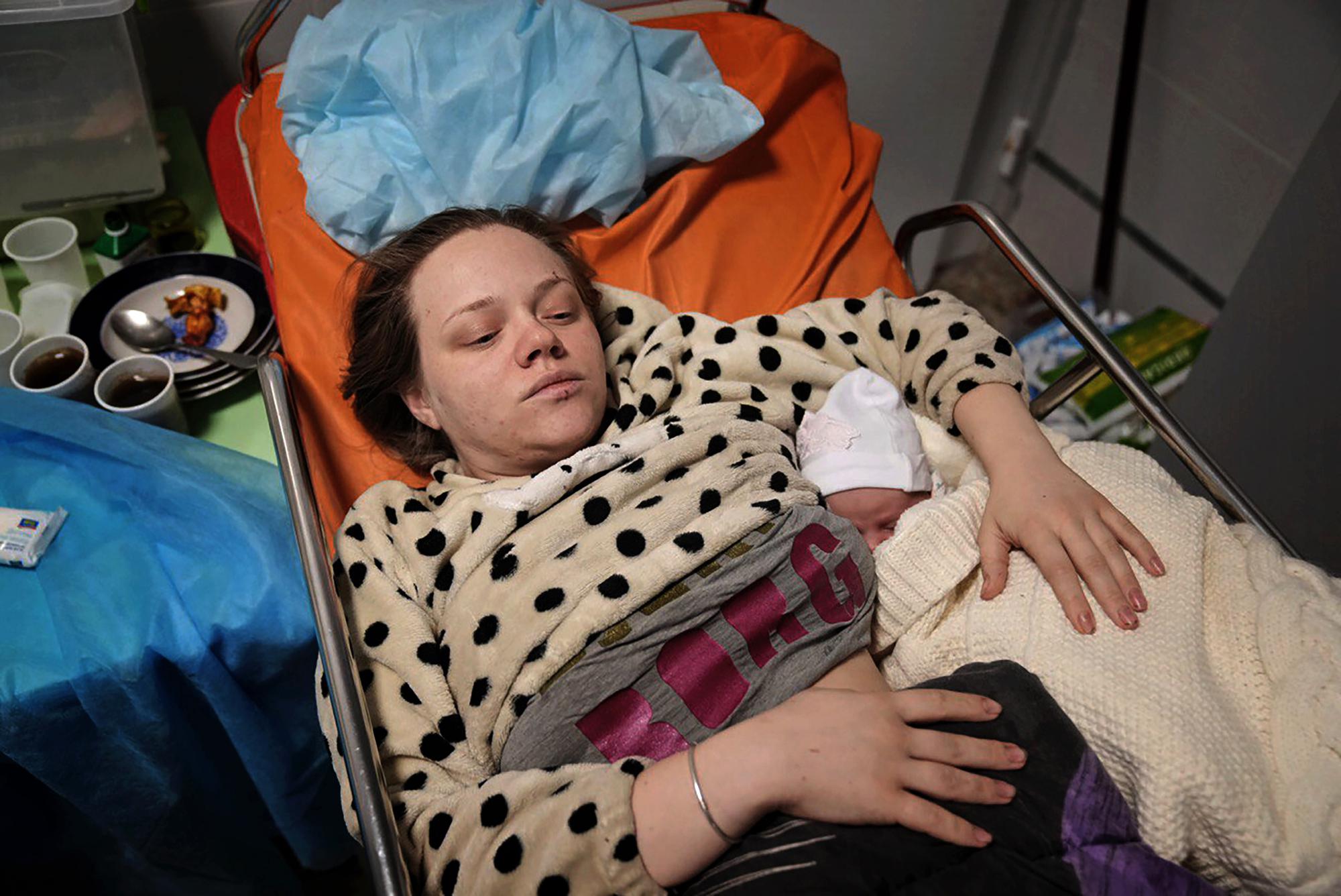 FILE - Mariana Vishegirskaya lies in a hospital bed after giving birth to her daughter Veronika, in Mariupol, Ukraine, Friday, March 11, 2022. Vishegirskaya survived the Russian airstrike on a children's and maternity hospital in Mariupol on Wednesday. (AP Photo/Evgeniy Maloletka, File)