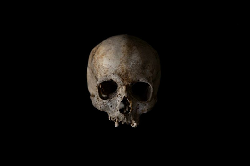 This Monday Oct. 1, 2018 photo shows the skull of an unidentified adult male found in 2017, brought to a Johannesburg mortuary for identification purposes. Once a demographic profile is estimated, it will go to the victim identification center in the South African police department to create a facial reconstruction. (AP Photo/Bram Janssen)