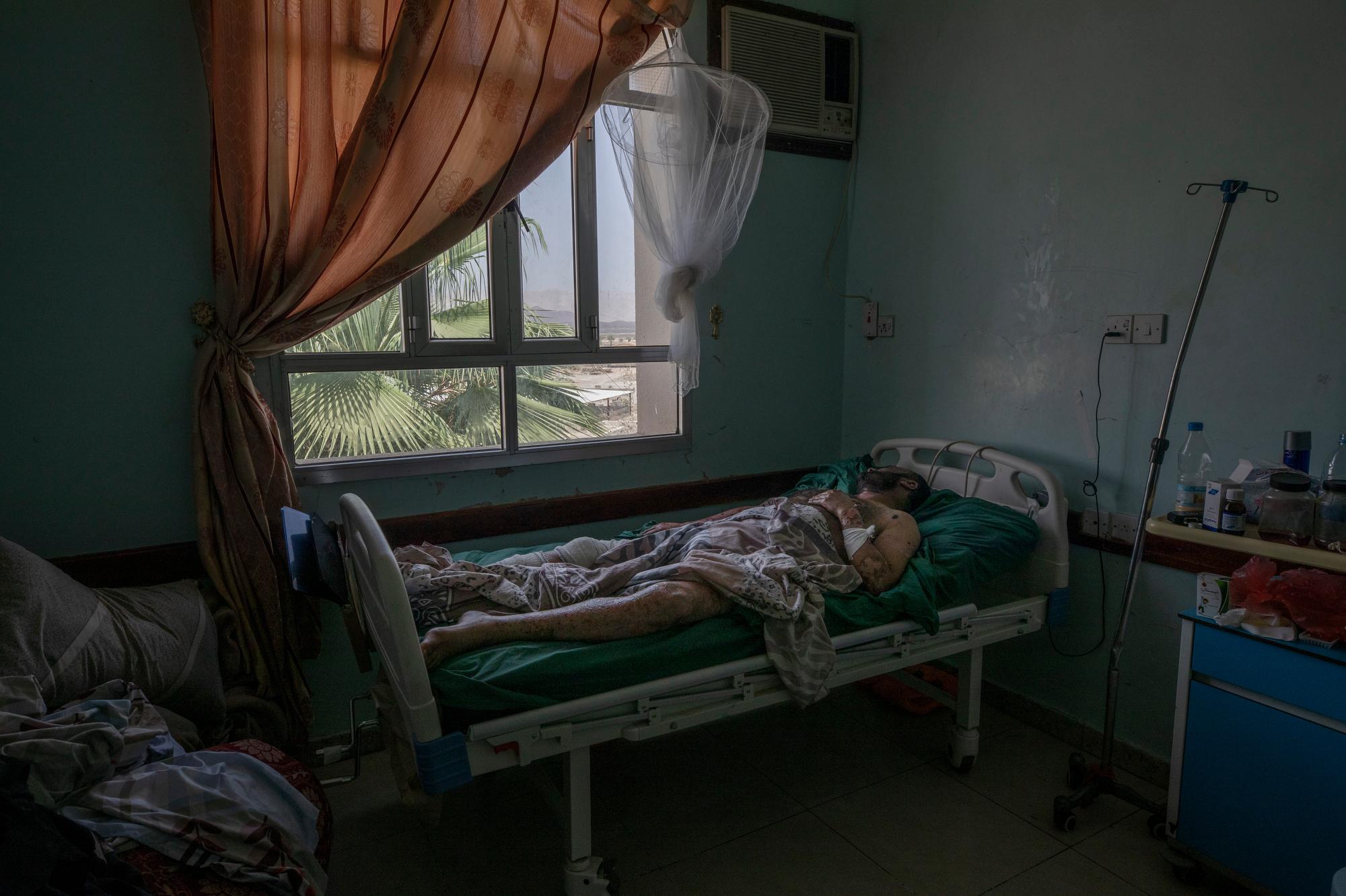 A Yemeni man who was severely injured when a ballistic missile and an explosive-laden drone fired by Yemen's Houthi rebels hit a fuel station in the Rawdha neighborhood of Marib, Yemen, receives treatment at a hospital in Marib, on June 21, 2021. (AP Photo/Nariman El-Mofty)