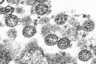 Foto del coronavirus tal como se ve en un microscopio. Foto tomada en el 2020 y facilitada por los Centros de Control y Prevención de Enfermedades de EEUU (C.S. Goldsmith, A. Tamin/CDC via AP)