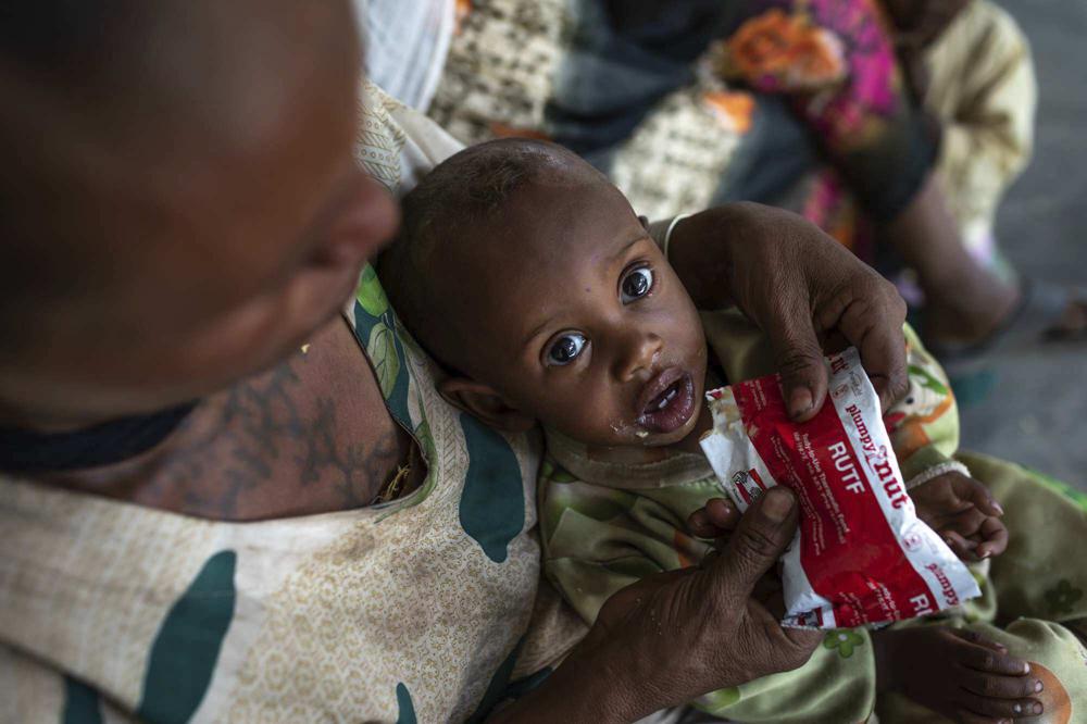 Letmedhin Eyasu holds her one year-old son Zewila Gebru, who is suffering from malnutrition at a health center in Agbe, Ethiopia Monday, June 7, 2021. For months, the United Nations has warned of famine in Tigray and now internal documents and witness accounts reveal the first starvation deaths since Ethiopia's government in June imposed what the U.N. calls 