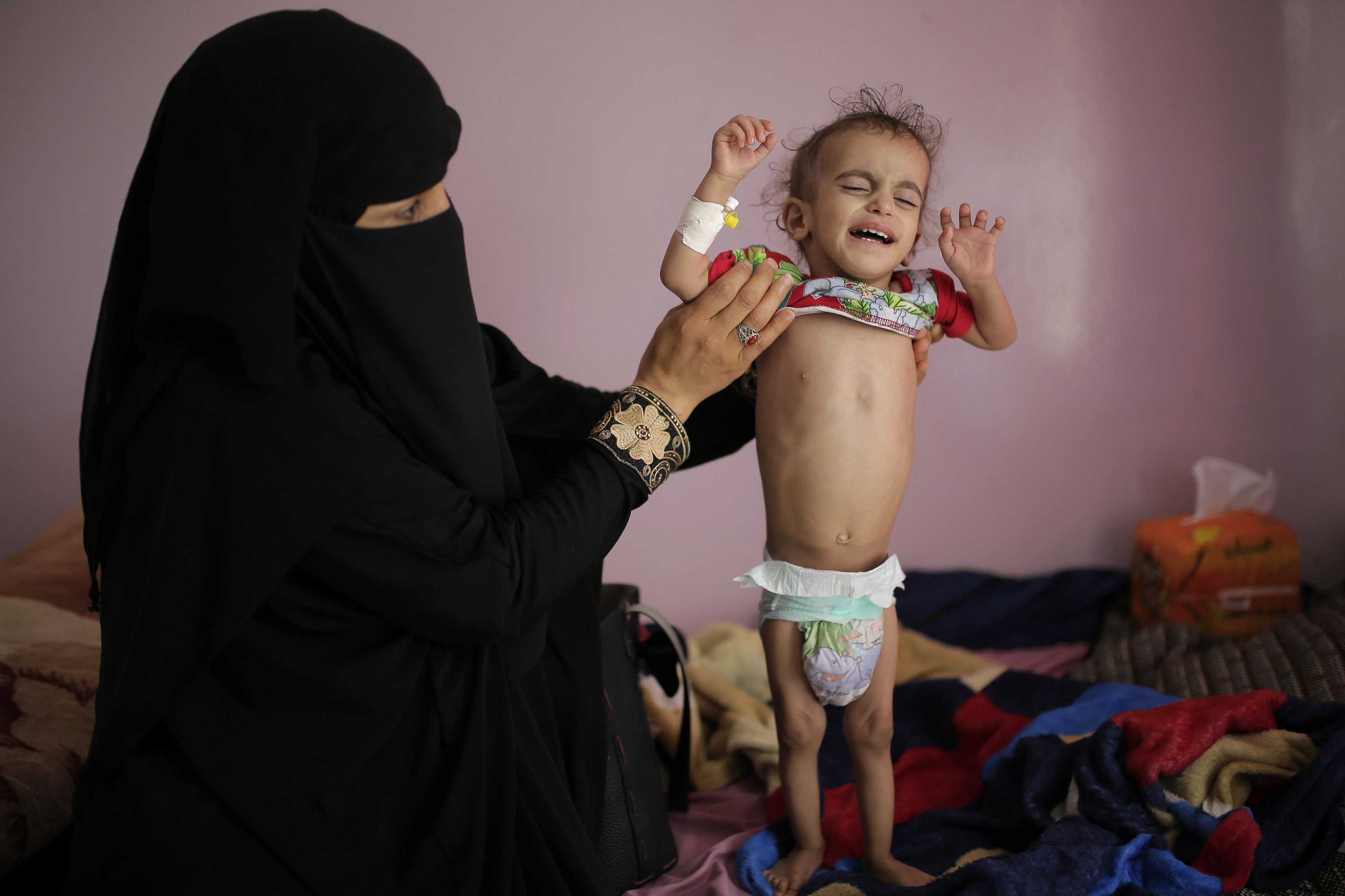 The head of the UN for food aid visits Yemen, he is afraid of famine