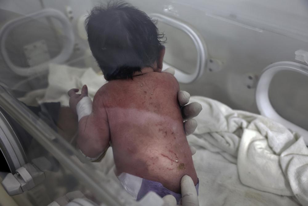 A baby girl who was born under the rubble caused by an earthquake that hit Syria and Turkey receives treatment inside an incubator at a children's hospital in the town of Afrin, Aleppo province, Syria, Tuesday, Feb. 7, 2023. Residents in the northwest Syrian town discovered the crying infant whose mother gave birth to her while buried underneath the rubble of a five-story apartment building levelled by this week’s devastating earthquake, relatives and a doctor say. (AP Photo/Ghaith Alsayed)