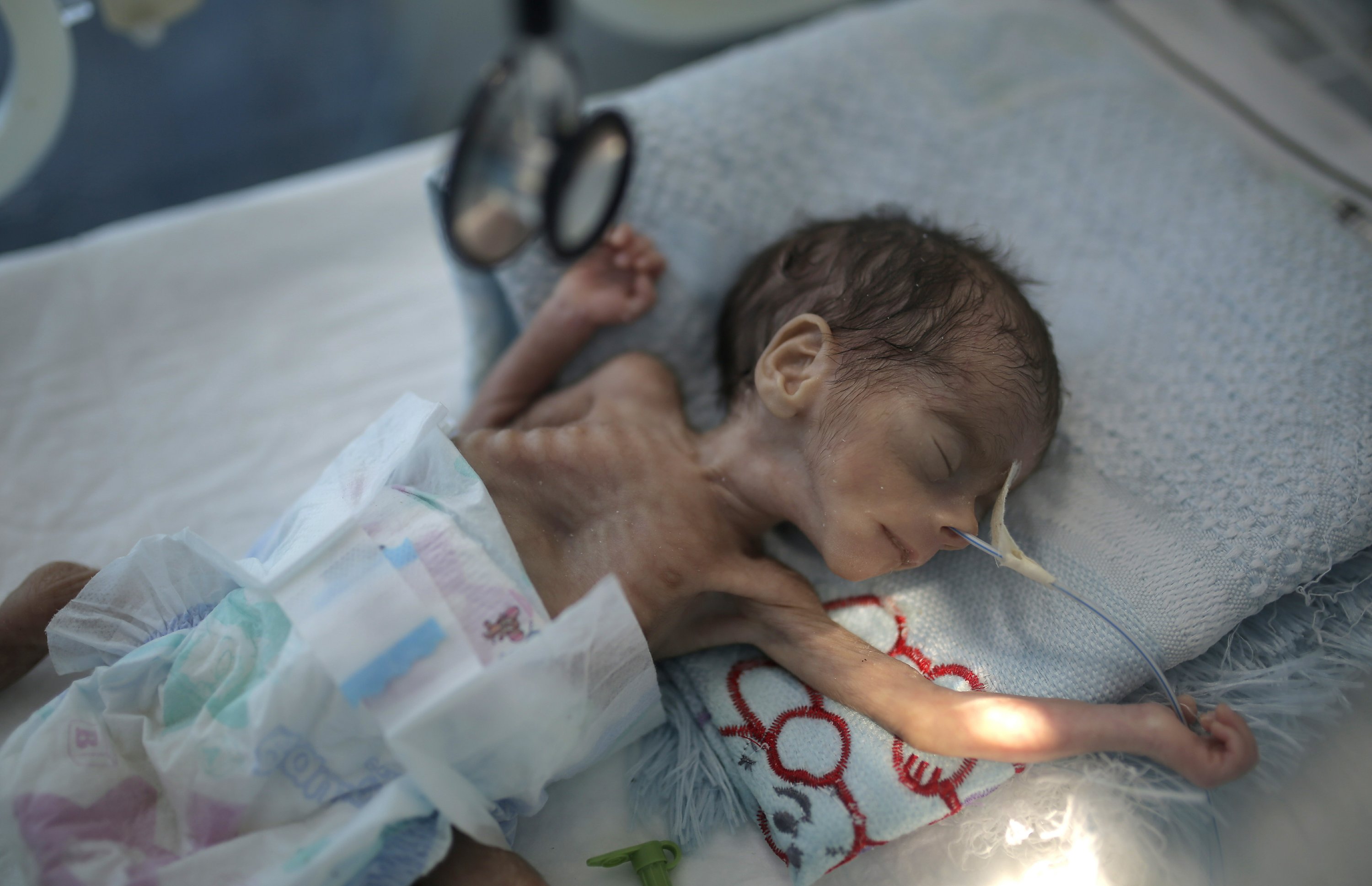 UNICEF Hambre Podr a Afectar A Millones De Ni os Yemen es AP News unicef-hambre-podr-a-afectar-a-millones-de-ni-os-yemen-es-ap-news