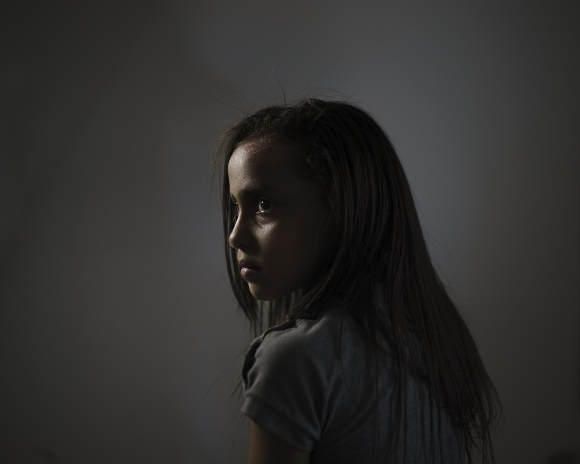 Suzy Ishkontana, 7, poses for a portrait in the house of a family member where she is currently living after her house was destroyed in an airstrike during an 11-day war in Gaza City, Wednesday, June 16, 2021. Suzy's mother, her two brothers and two sisters -- ages 9 to 2 -- died in the May 16 Israeli attack on the densely packed al-Wahda Street in Gaza City. Israeli authorities say the bombs' target was Hamas tunnels; 42 people died, including 16 women and 10 children. “My kids who died and my wife, they are now in a safe place and there is no worry about them, but my greater fear is for Suzy,” says her father, Riad Ishkontana. (AP Photo/Felipe Dana)