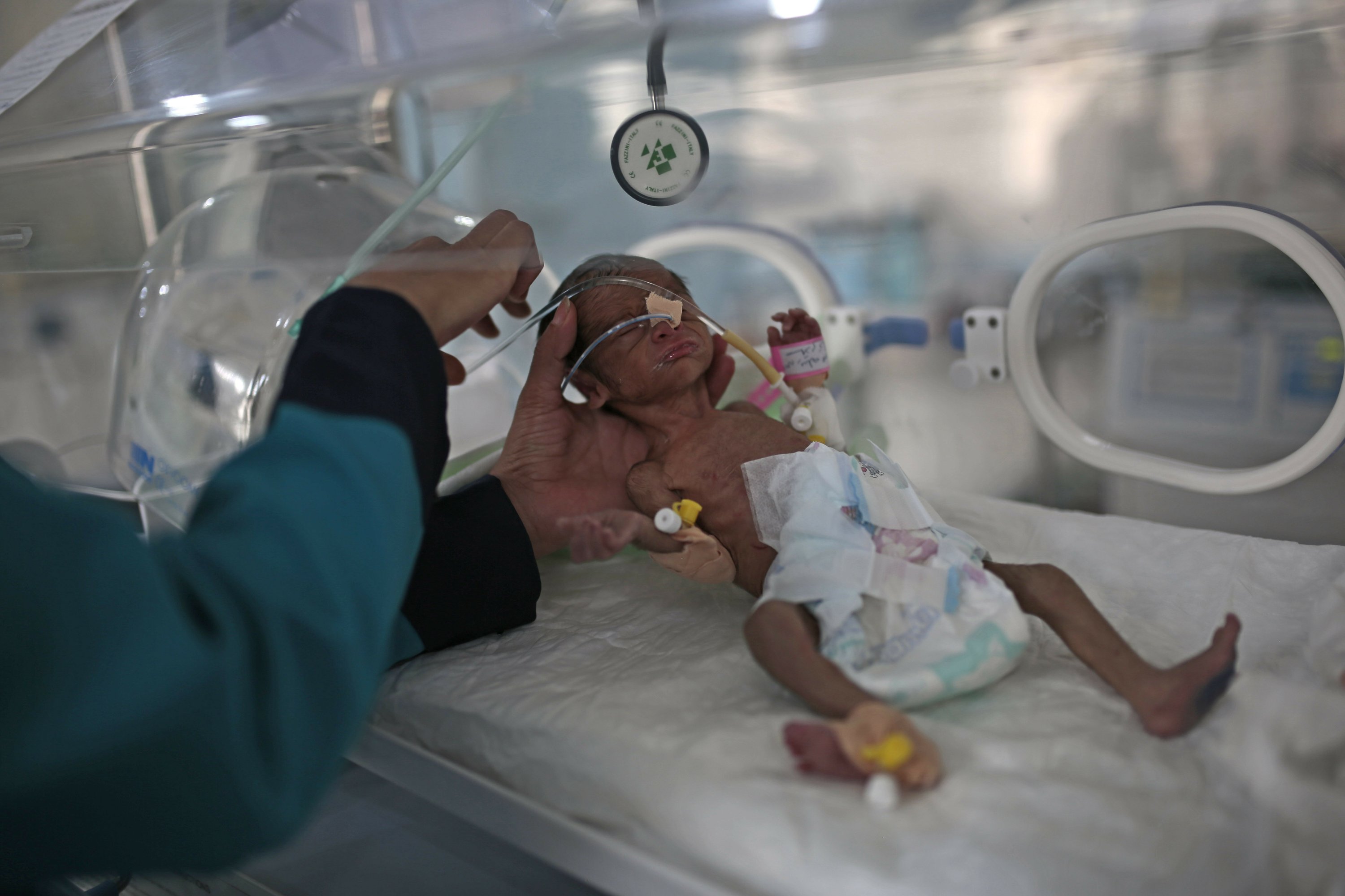 More than 2 million children in Yemen could starve to death in 2021