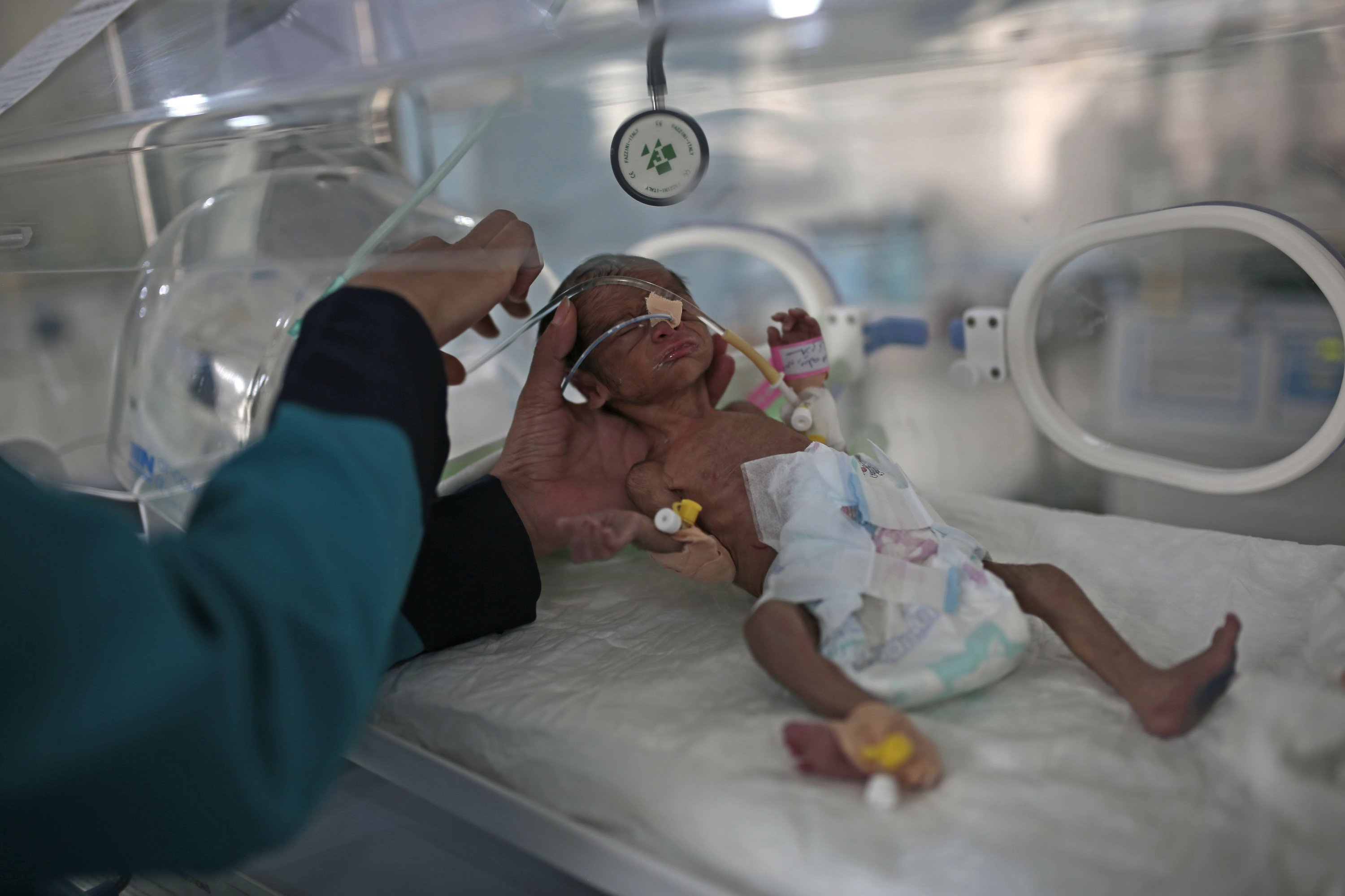 More than 2 million Yemeni children may die of hunger in 2021