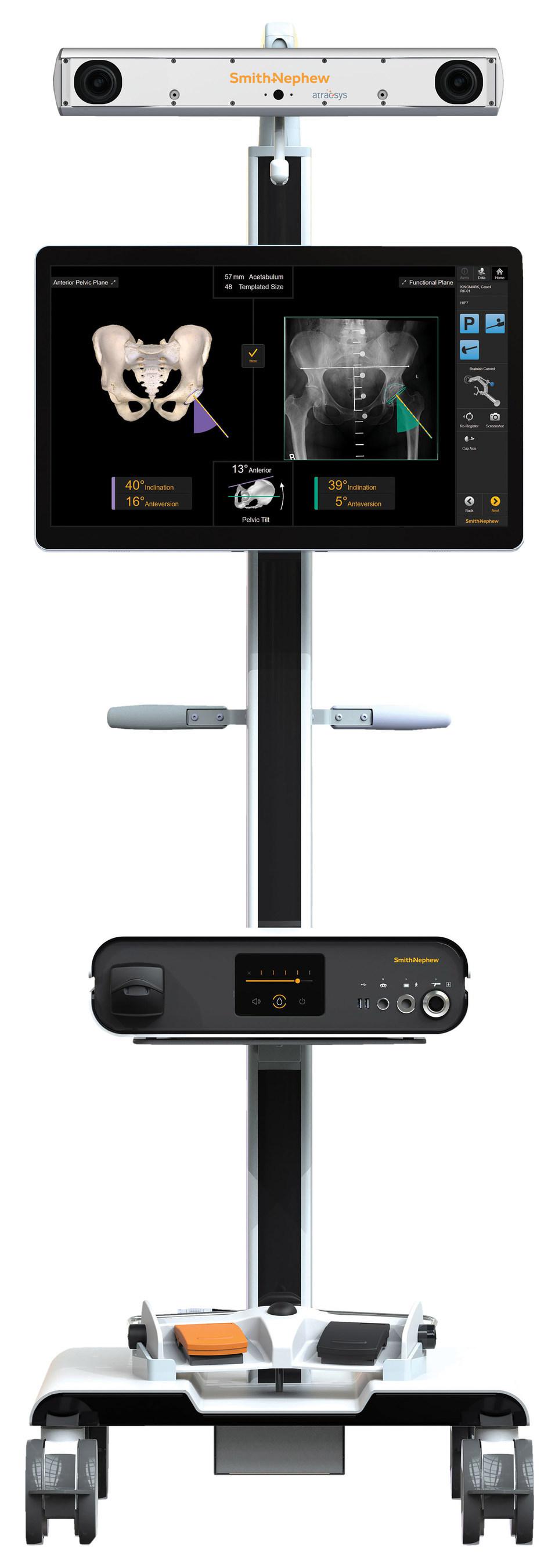 Smith+Nephew expands nextgeneration handheld roboticassisted CORI™ Surgical System into total