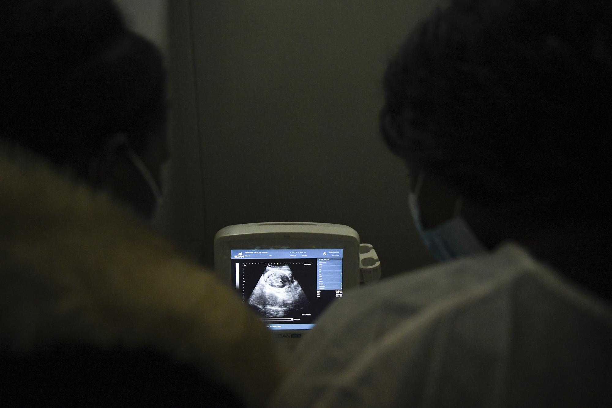 Nurses and midwives look at a sonogram at Ndirande Health Centre northeast of the country's commercial capital of Blantyre, Malawi, Wednesday, June 16, 2021. At Ndirande and other clinics, nurses, aides and medical midwives give pregnant women ultrasounds and use equipment to monitor mother and baby. (AP Photo/Thoko Chikondi)