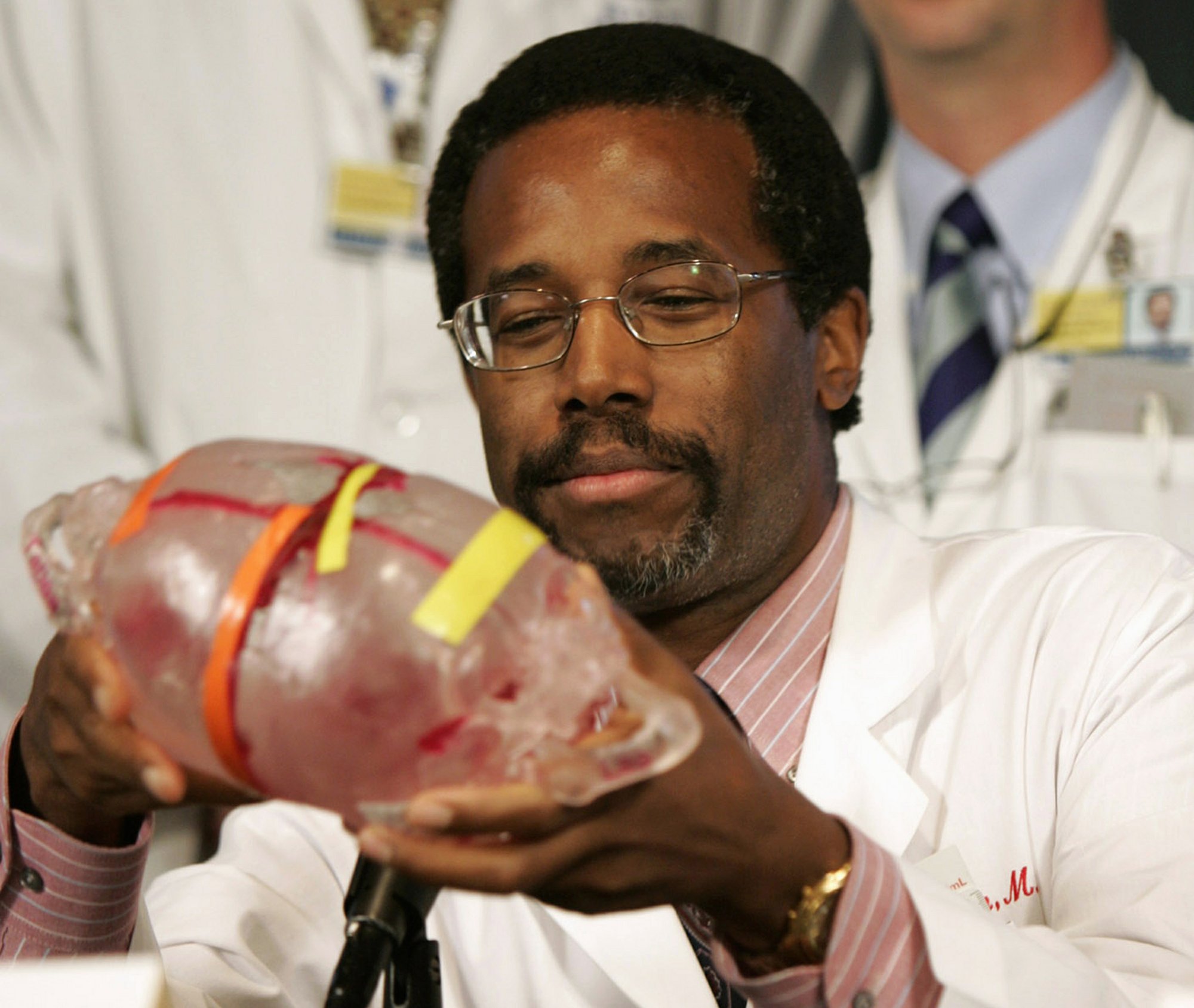 ben carson s politics