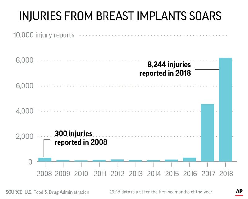 BREAST IMPLANTS