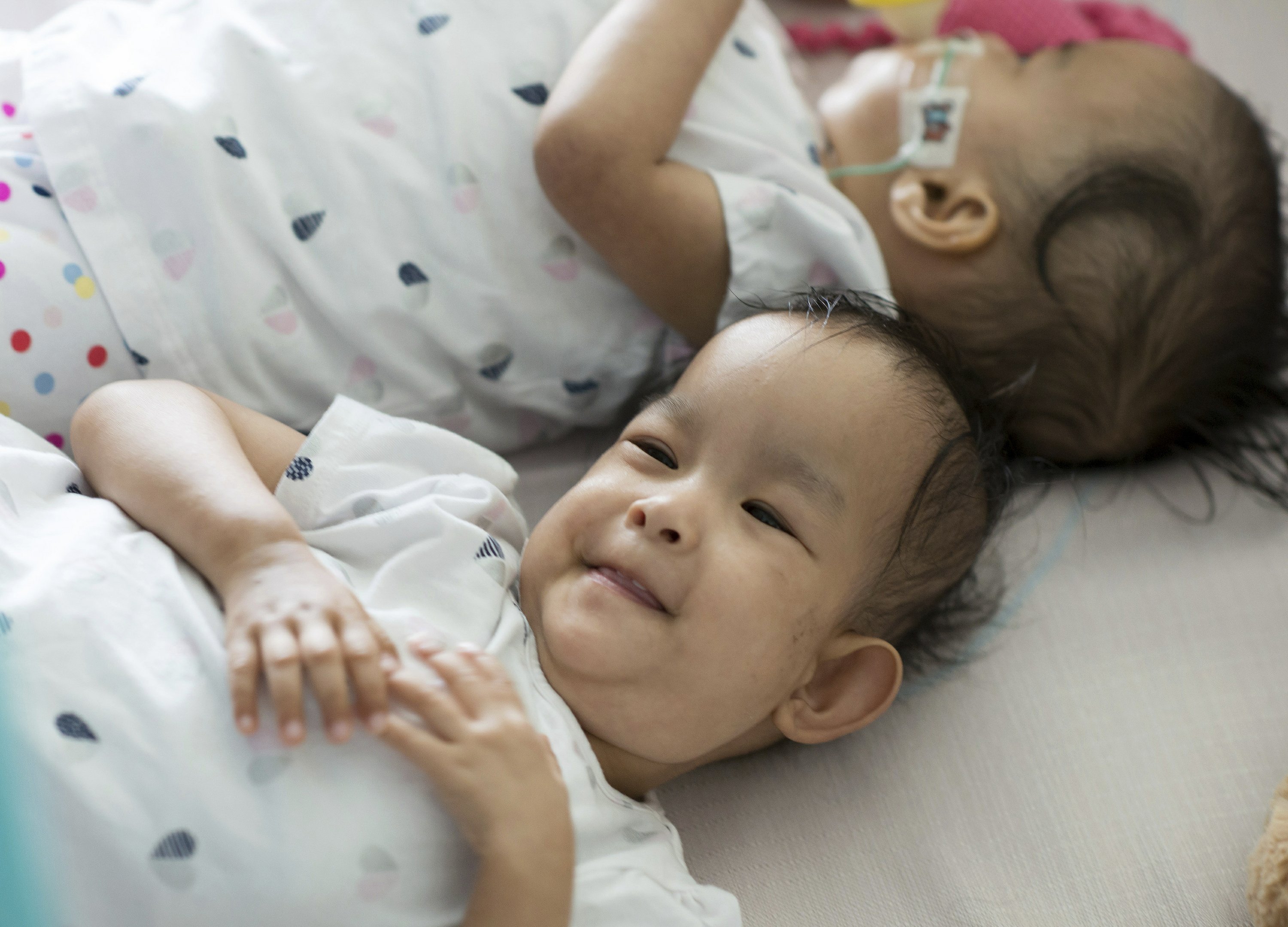 Сиамские близнецы проект