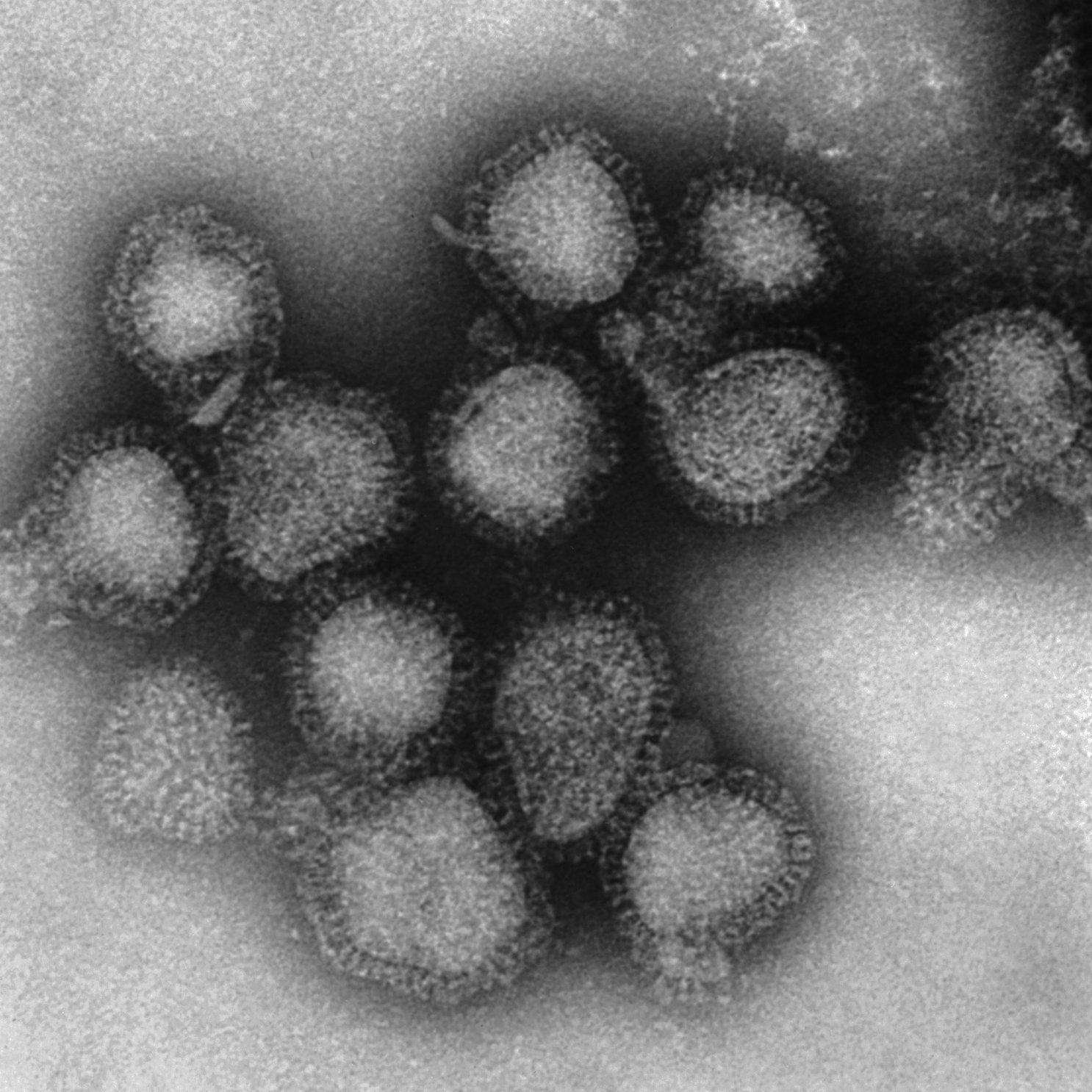 Возбудитель гриппа. Вирус h1n1 испанка. Вирус гриппа h1n1. Вирус под микроскопом h1n1. Вирус испанки под микроскопом.