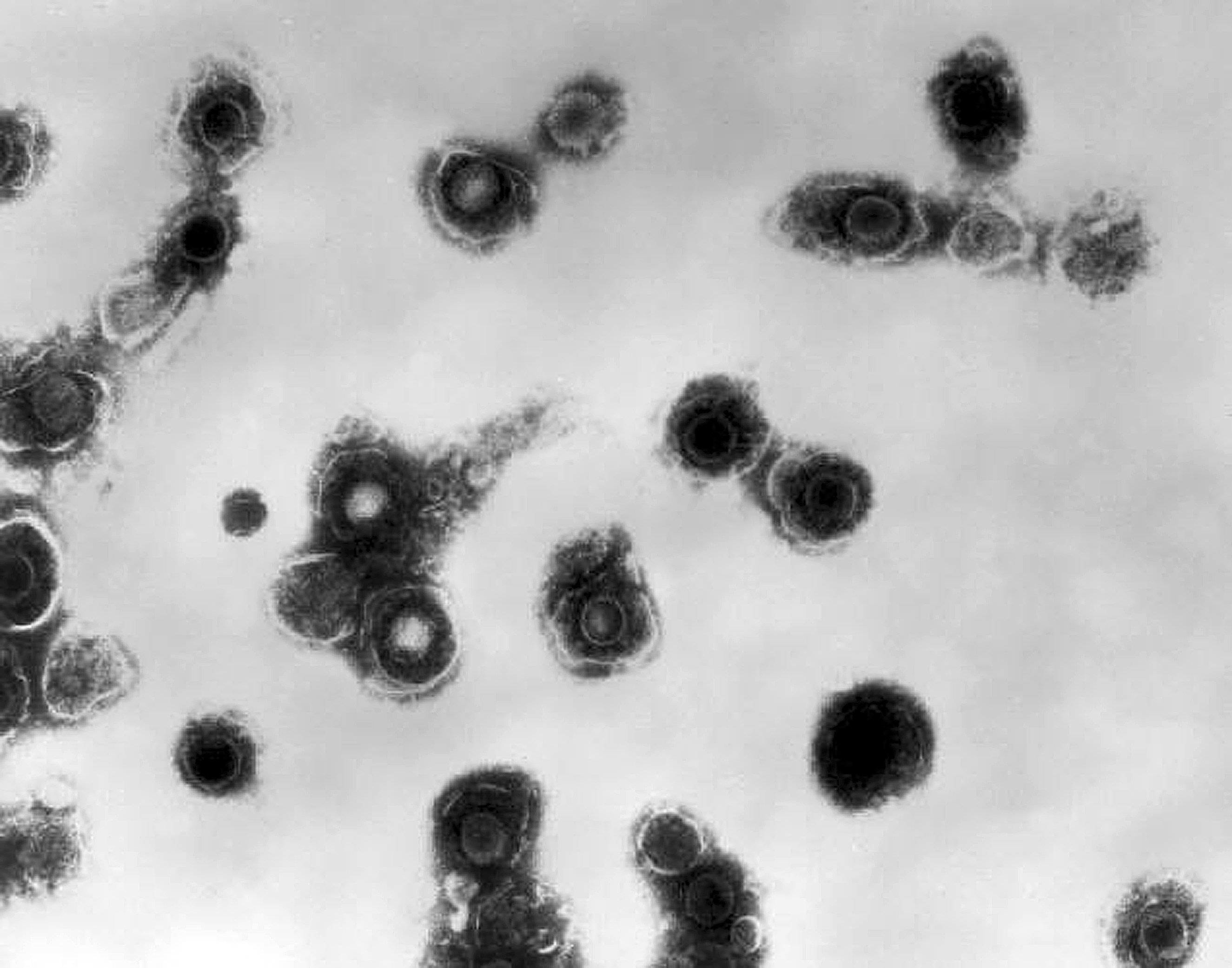 Thousands of young US children get no vaccines, survey finds