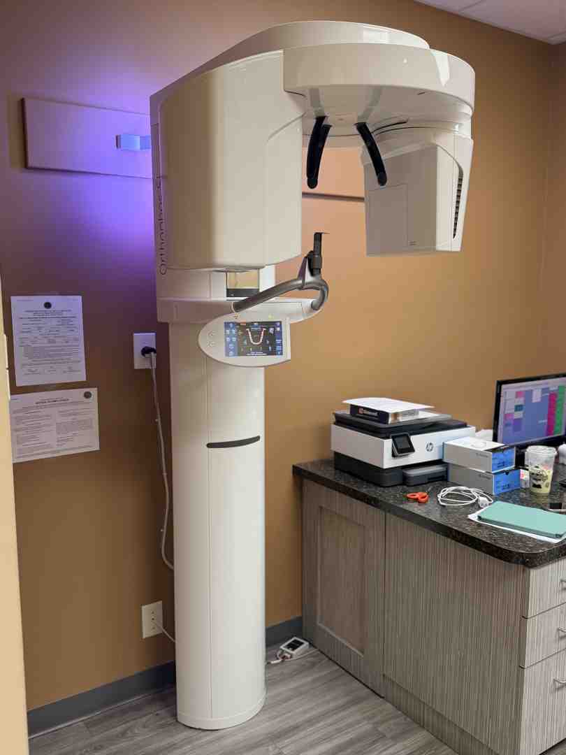Modern 3D dental imaging technology showing a digital map of teeth alignment - Braces for adults