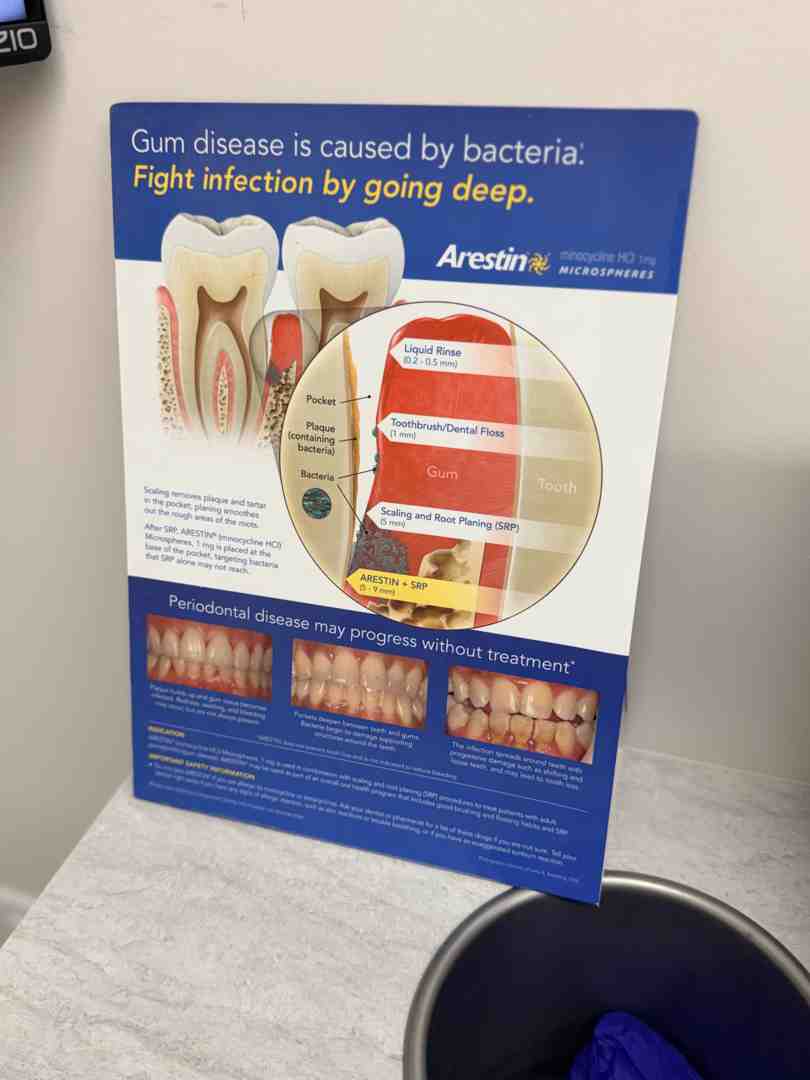 healthy gums vs inflamed gums showing plaque buildup and pocket formation healthy gums vs inflamed gums showing plaque buildup and pocket formation