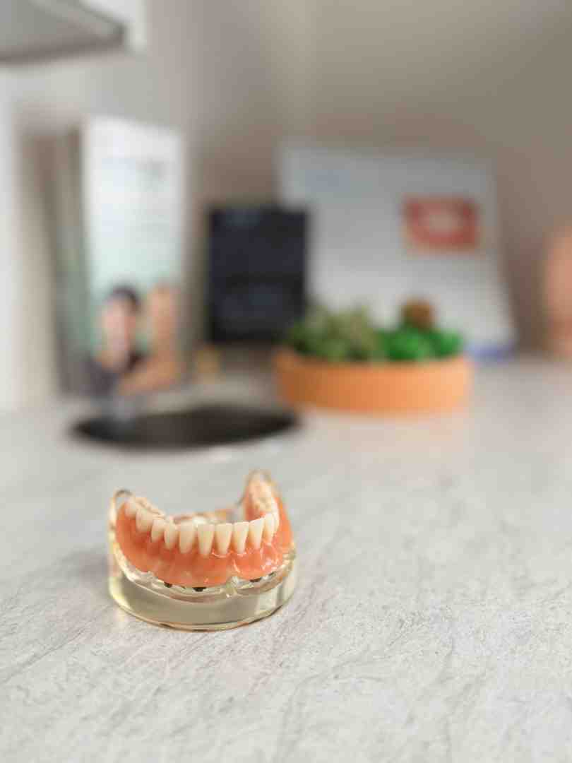 Comparing custom fitted teeth guards with cheap over-the-counter alternatives