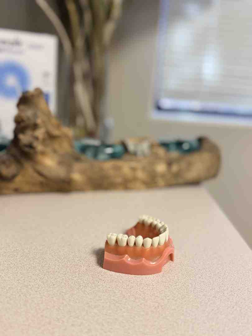 Comparison of worn tooth enamel from bruxism versus healthy, protected enamel