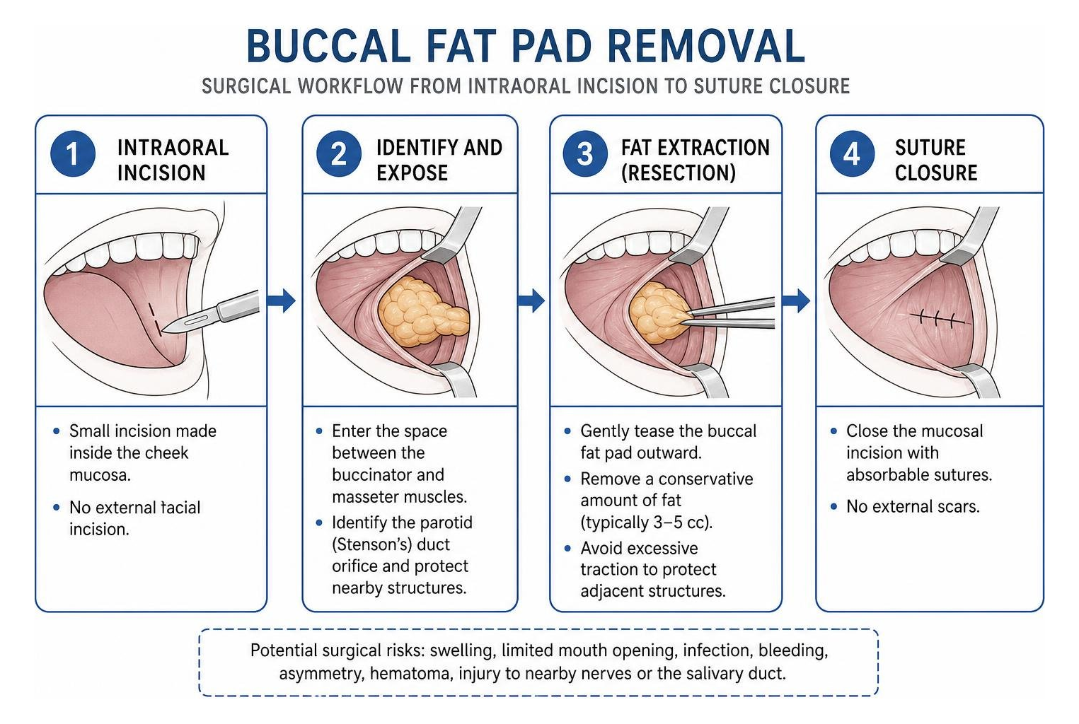 Surgical workflow from intraoral incision to suture closure
