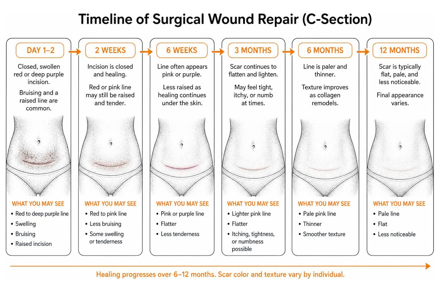 timeline of surgical wound repair timeline of surgical wound repair
