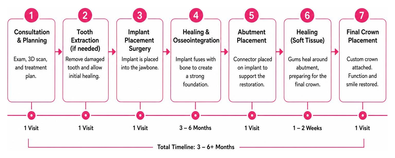 Step-by-step timeline of the dental implant surgical and healing process