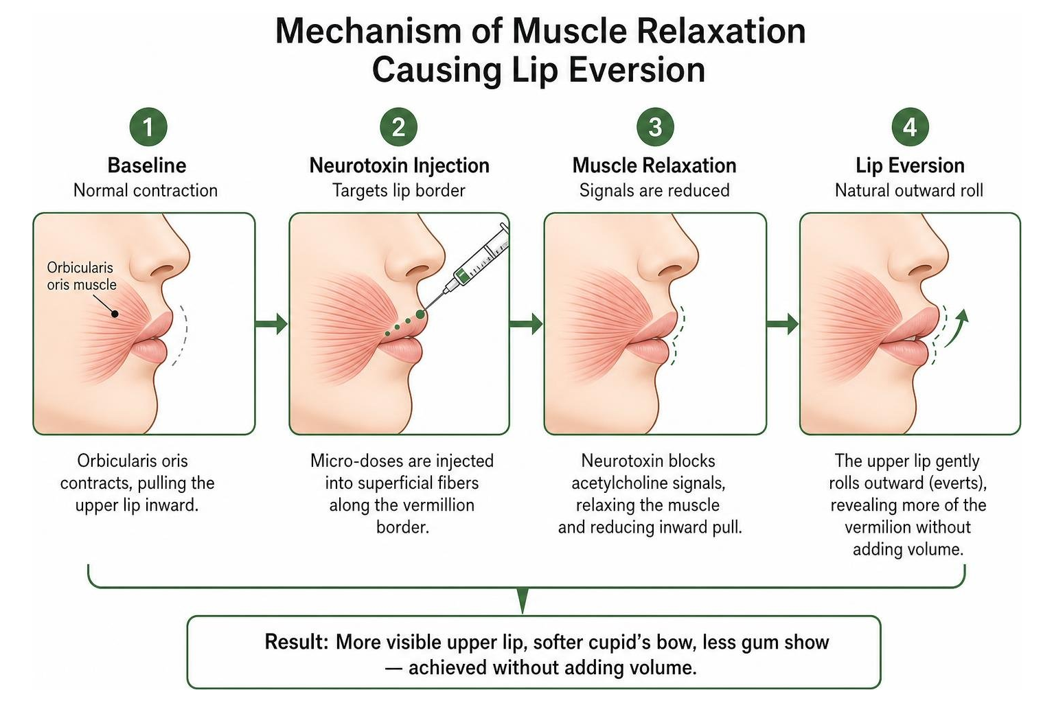 Mechanism of muscle relaxation causing lip eversion Mechanism of muscle relaxation causing lip eversion