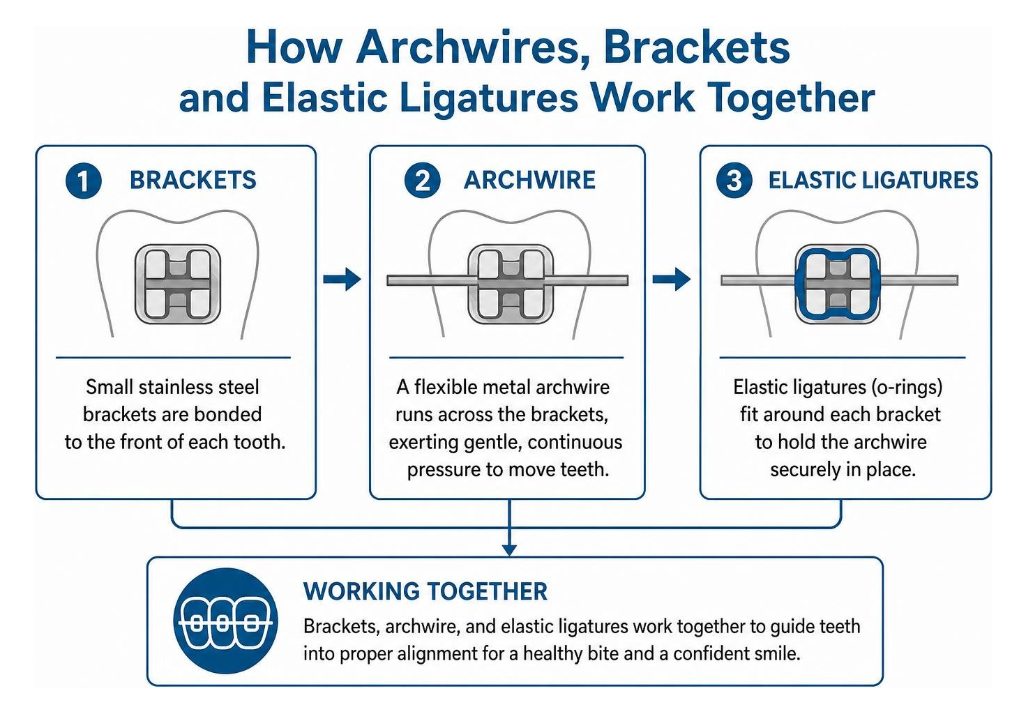 How archwires brackets and elastic ligatures work together How archwires brackets and elastic ligatures work together
