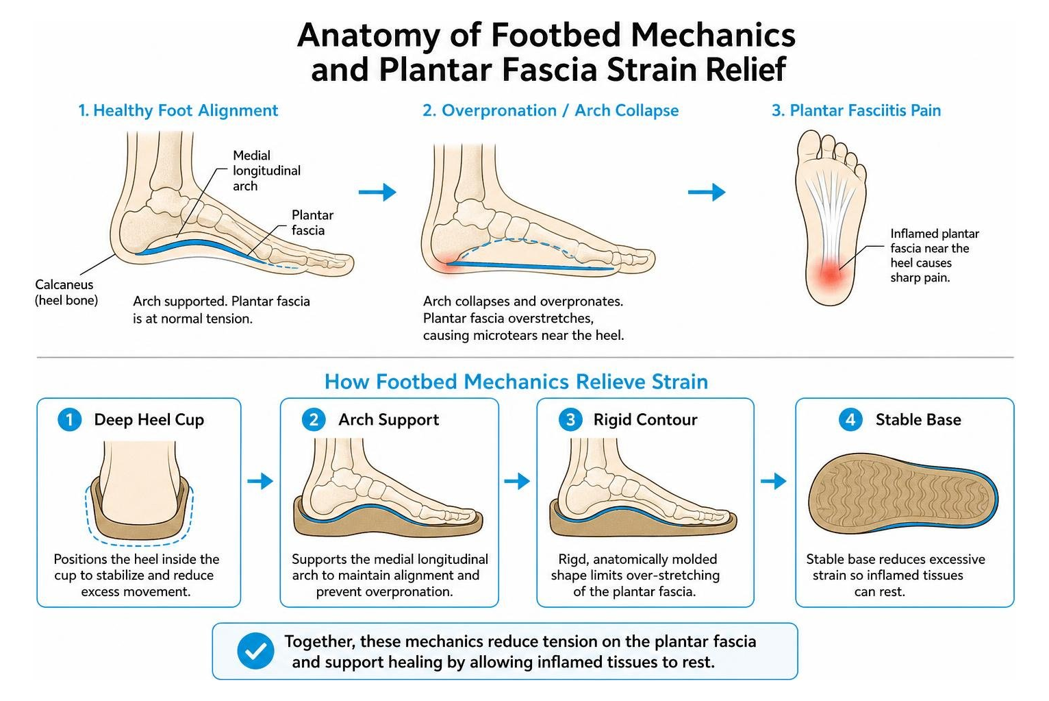 Anatomy of footbed mechanics and plantar fascia strain relief