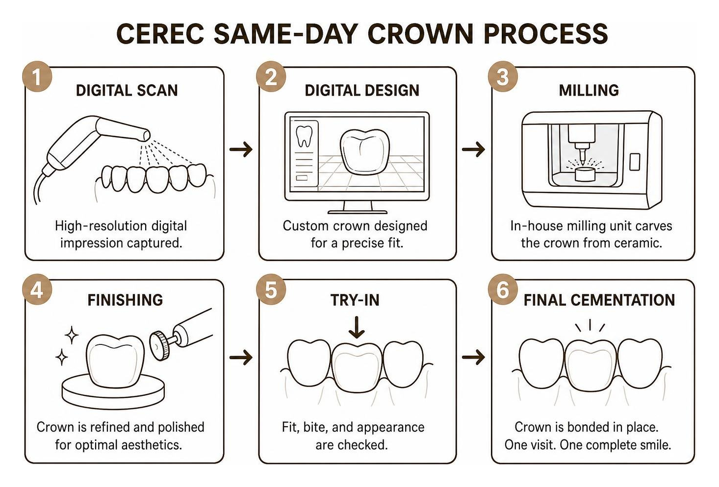 CEREC same day crown digital design and milling process CEREC same day crown digital design and milling process