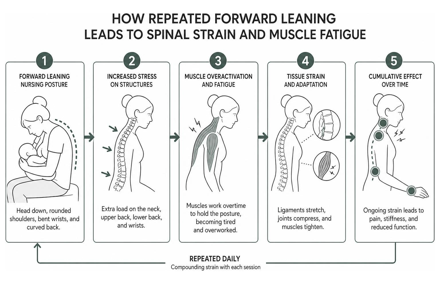 diagram showing how repeated forward leaning leads to spinal strain and muscle fatigue