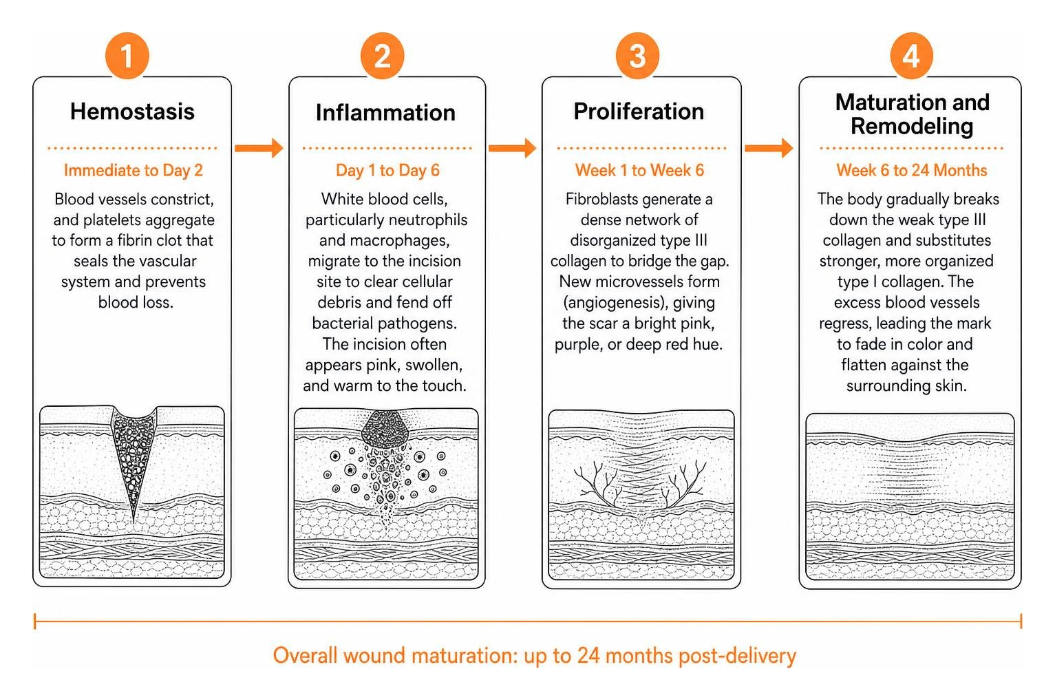 Wound healing timeline stages