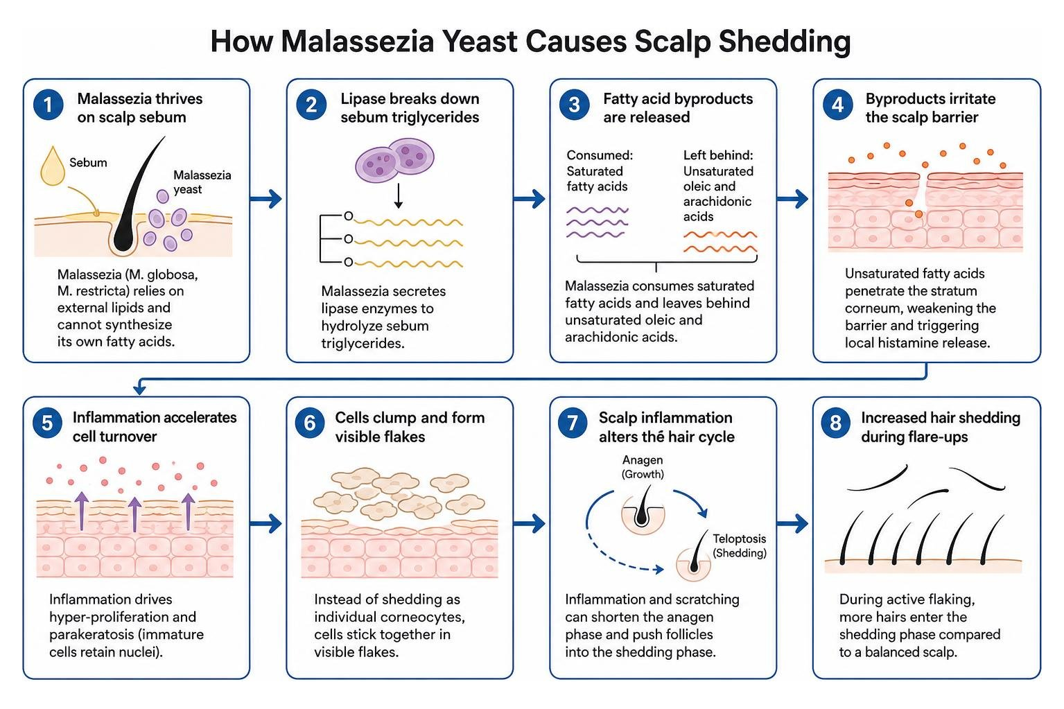 The biological mechanism of Malassezia yeast feeding on sebum lipids and causing scalp shedding The biological mechanism of Malassezia yeast feeding on sebum lipids and causing scalp shedding