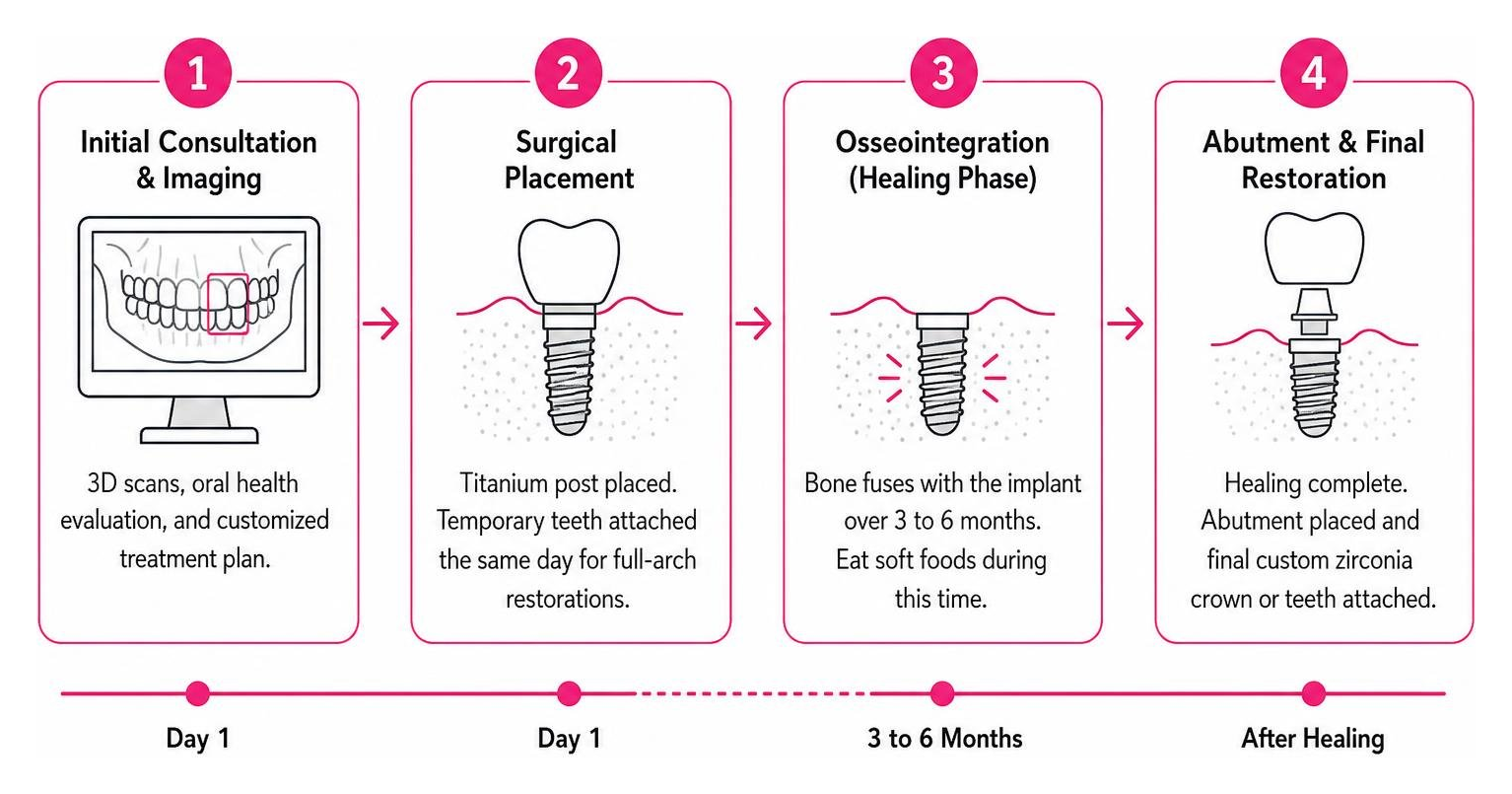 Timeline of the dental implant process from consultation to final restoration placement