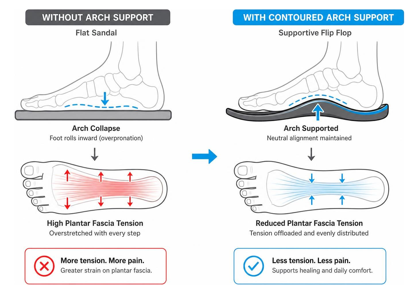 diagram showing tension offloading on plantar fascia with contoured arch support diagram showing tension offloading on plantar fascia with contoured arch support