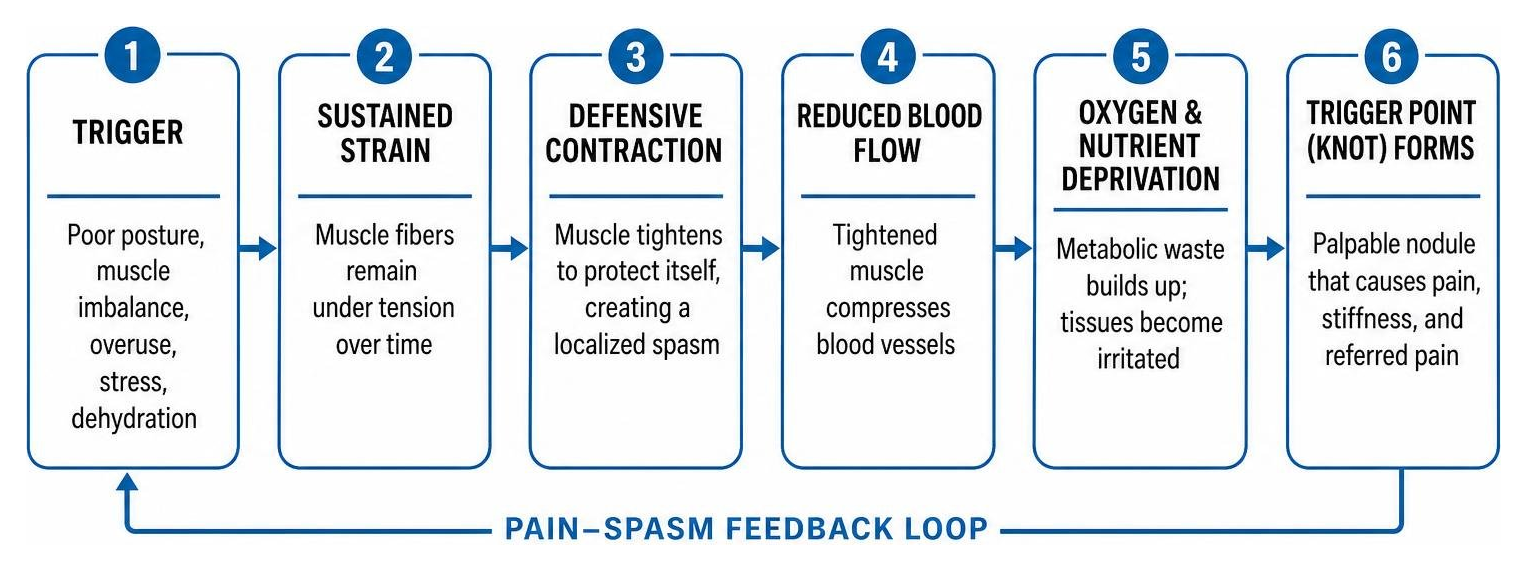 Cause and effect chain of muscle knot formation in the lower back Cause and effect chain of muscle knot formation in the lower back