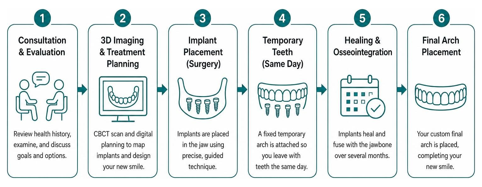 Workflow diagram of the full arch dental implant procedure